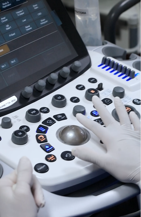 Ecografía endoscópica esófago